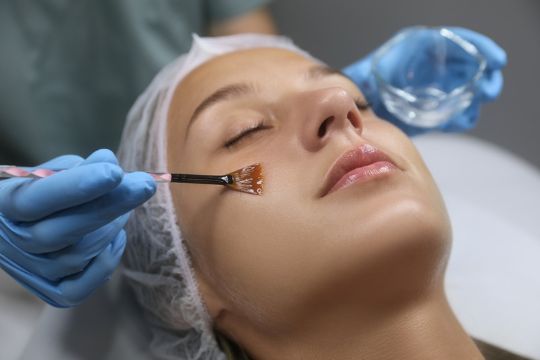 Chemical peels