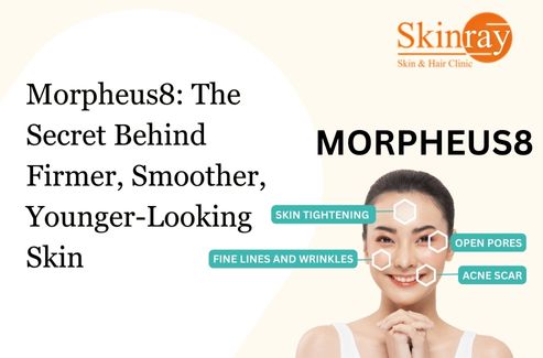 Morpheus8