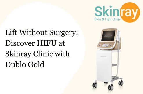 Lift Without Surgery