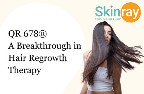 QR 678® _ A Breakthrough in Hair Regrowth Therapy